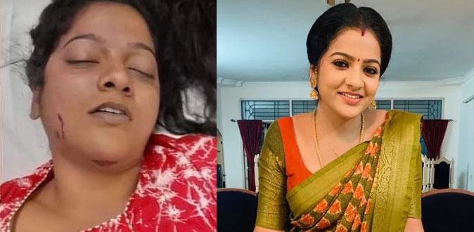 நடிகை சித்ராவின் மரணம் கொலையா? - சந்தேகம் எழுப்பும் காயங்கள்